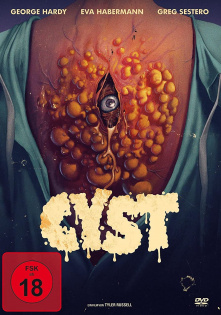 stream Cyst