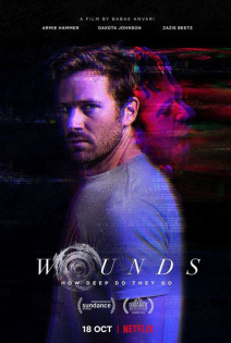 stream Wounds